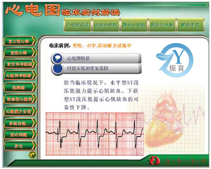 新版心電圖教學軟件